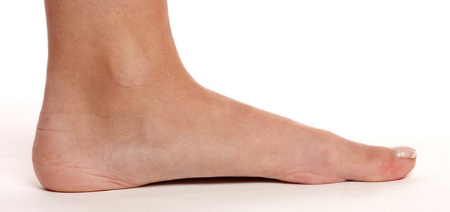 skechers for flat feet