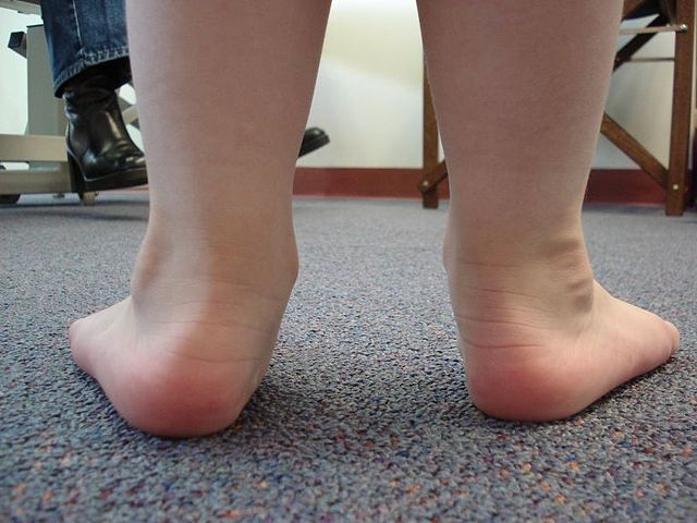 ultraboost flat feet