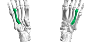 Ecco Shoes for Metatarsalgia